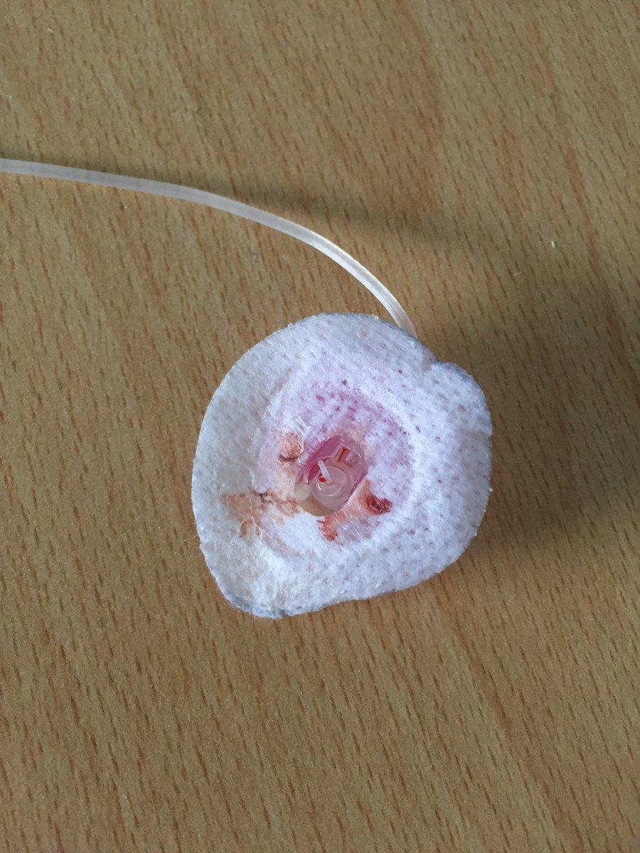 Type1Adventures's tweet photo. When your #BGs start to climb, the #cannula starts to hurt and so you do a #SetChange and discover this ๐๐ณ that would be why then! #gbdoc https://t.co/WlZc1NoMK3