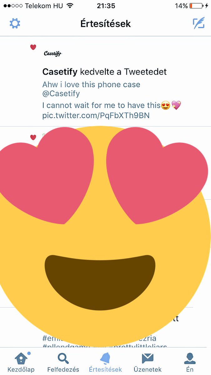 Pllendgamelil's tweet photo. Tysm @Casetify 💕☺️🙏
#pllendgame #casetify https://t.co/Elnv00YJSn