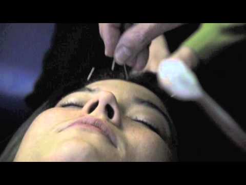 AcupunctureCNet's tweet photo. #acupuncture acupuncture treating headaches - https://t.co/Voegrafhnl #RT #Retweet https://t.co/j9RVD3ymCd