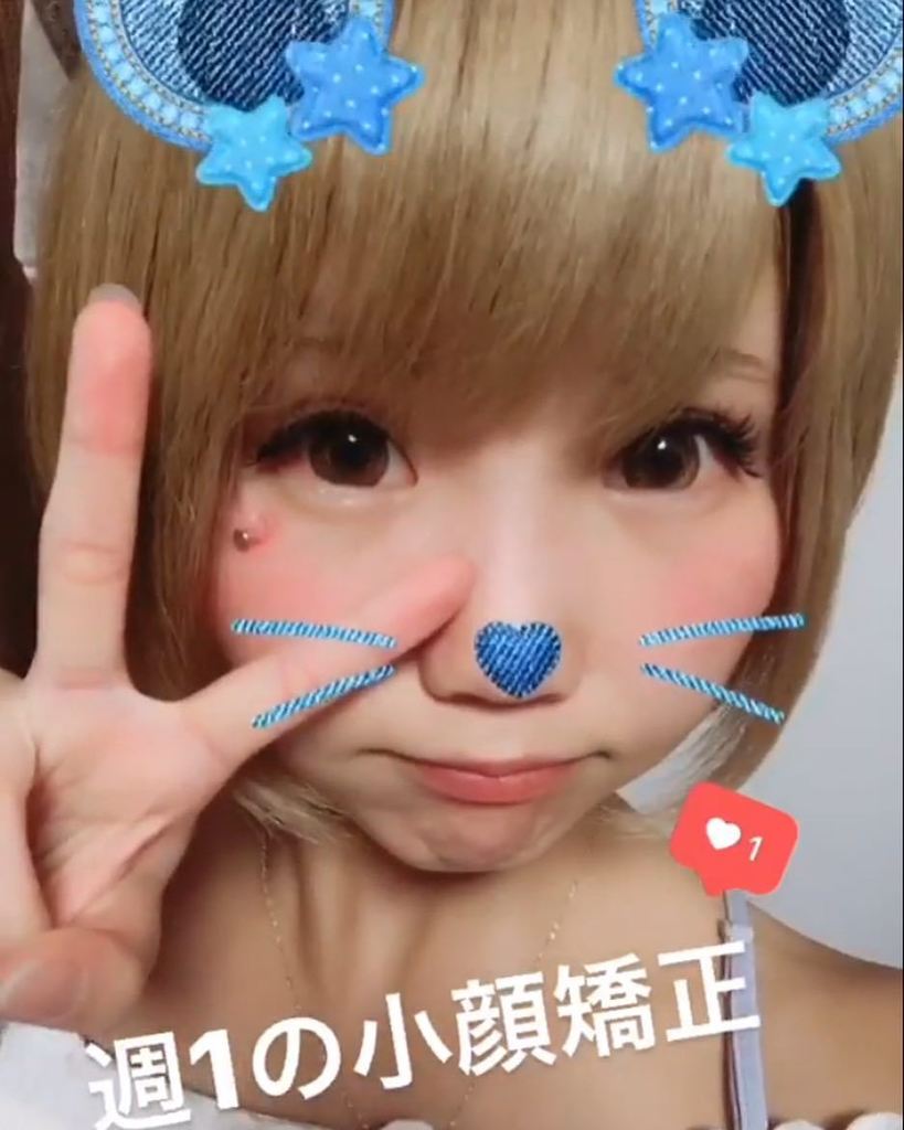 まるちゃん総院長3d小顔矯正 楽体 先程 Djもされてますアユウサさまが お帰りになりましたよ 業界no 1の小顔矯正の楽体では 頬骨を小さくする 頭を小さく まるくする 目を大きくする アゴ骨をしならして フェイスラインをシャープ