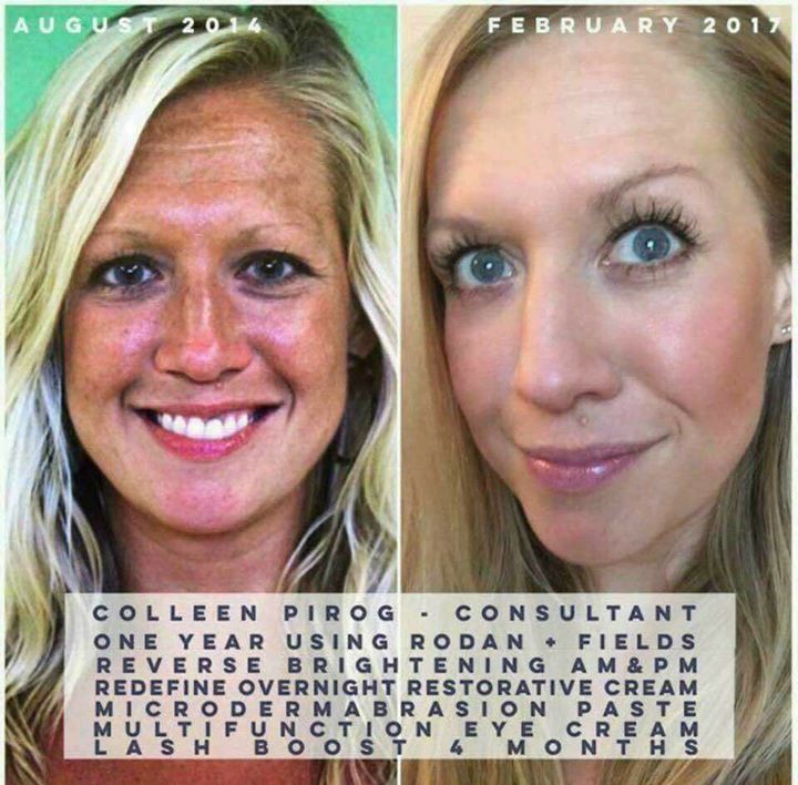 RyanInMiddle's tweet image. #healthyskin buff.ly/2s72WyD