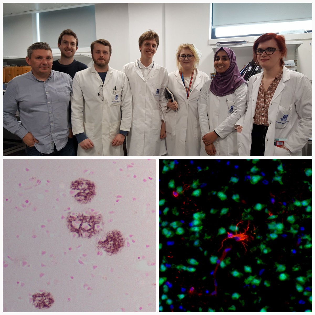 Thanks to the students that attended the Neuroscience Skills Workshop! Some lovely amyloid & astrocyte staining 👩‍🔬👨‍🔬 #MMU_SciEngAward