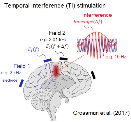 Noninvasive Deep Brain Stimulation - Neuroscience’s Holy Grail Found? blogs.discovermagazine.com/neuroskeptic/2… My take on the MIT Cell paper. New post!