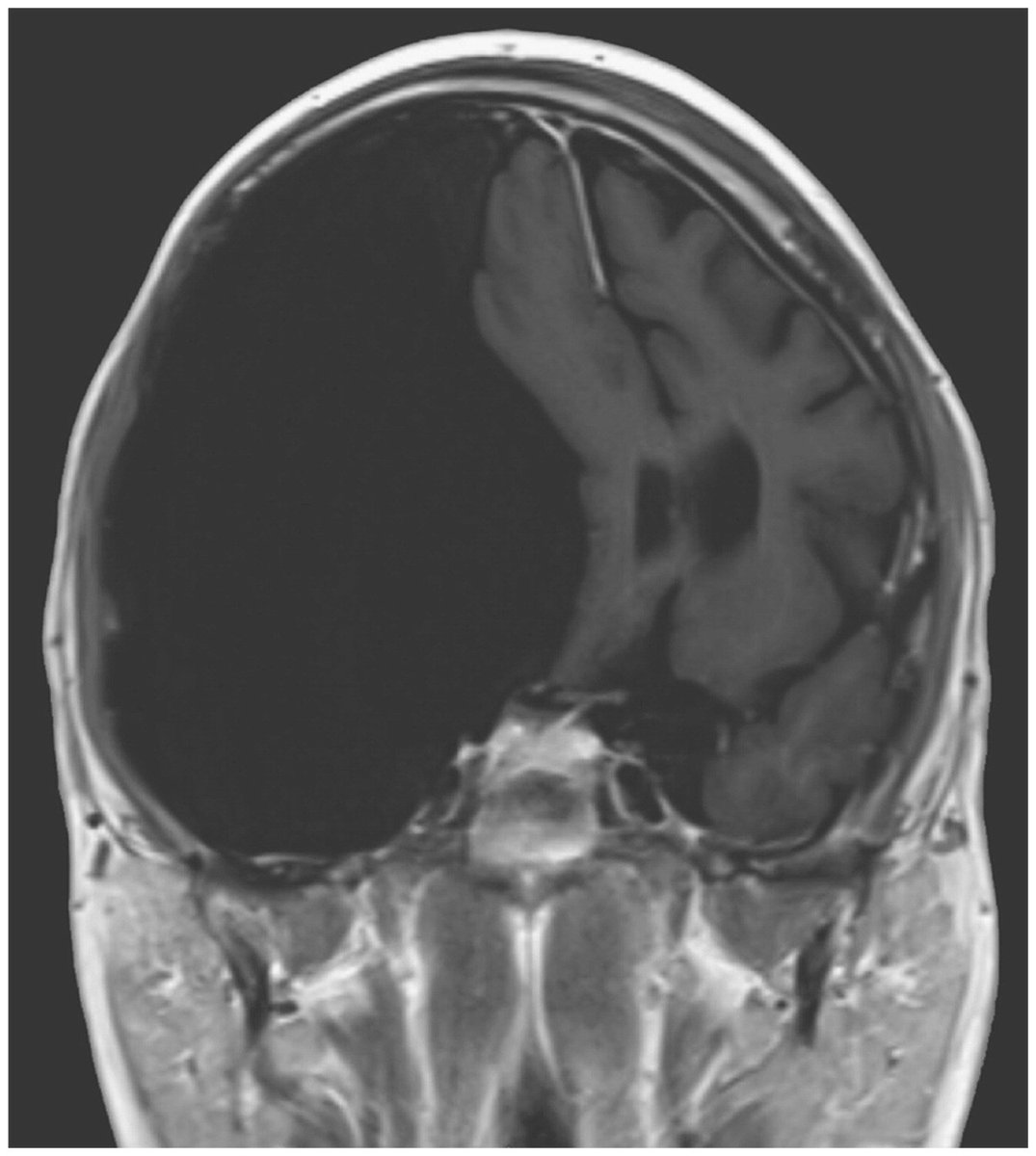 NEJM's tweet photo. Image of the Week: Headaches and Falls. This 27-year-old man presented with a seizure and headaches. https://t.co/5zudMLmtzO https://t.co/BWpNymwPWx