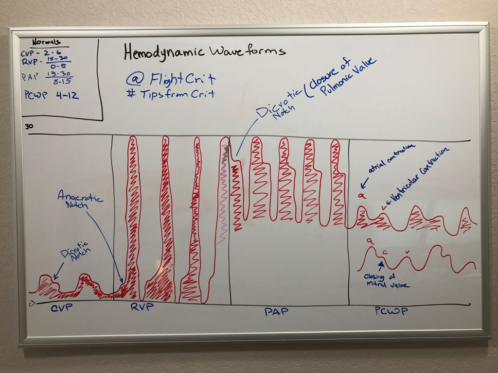 FlightCrit's tweet photo. Hemodynamics waveforms.
#TIPSfromCRIT
#FlightCrit #Paramedic #FOAMed #FOAMems https://t.co/VSTvp0RWAn