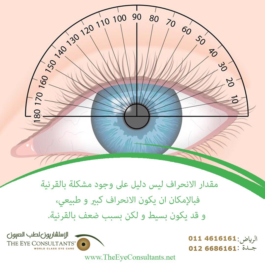 الاستشاريون لطب العيون V Twitter مقدار الانحراف ليس دليلا على وجود مشكلة في القرنية الاستشاريون لطب العيون