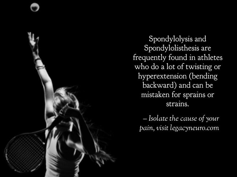 LegacyNeuro's tweet photo. Get back in the game! Please visit https://t.co/rQGzZWpObd @QuadFatherMft @aneurysmnv @neurosurgdoctor #backpain #lumbarfusion #misfusion https://t.co/2ekjNzpNpB