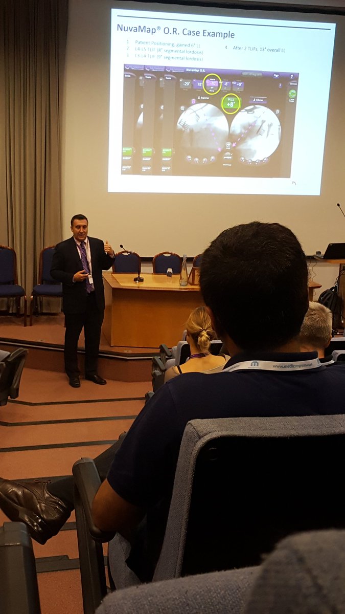IGA / NuvaMap case studies - in lecture theatre 2 now with Dennis Cirino  #Nspine <a href="/NuVasiveInc/">nuvasiveinc</a> #spinal #innovation