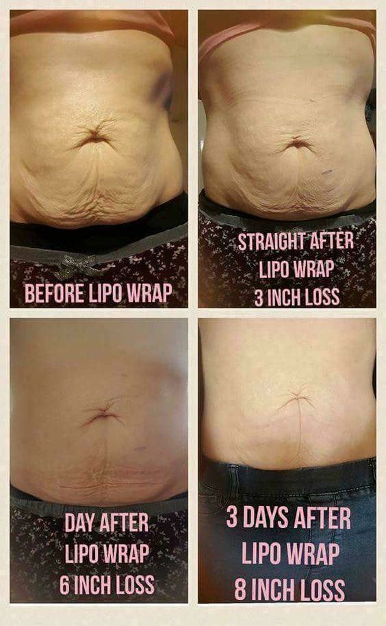 casingqueen's tweet image. Wrap Wendnesday! #actilabs #actilife #nodiet #love #instagood #photooftheday #beautiful #followme #follow #like4like #picoftheday