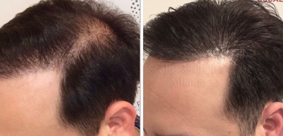 Follica On Twitter Cosmetic Tattoo Gilbert Az 85296