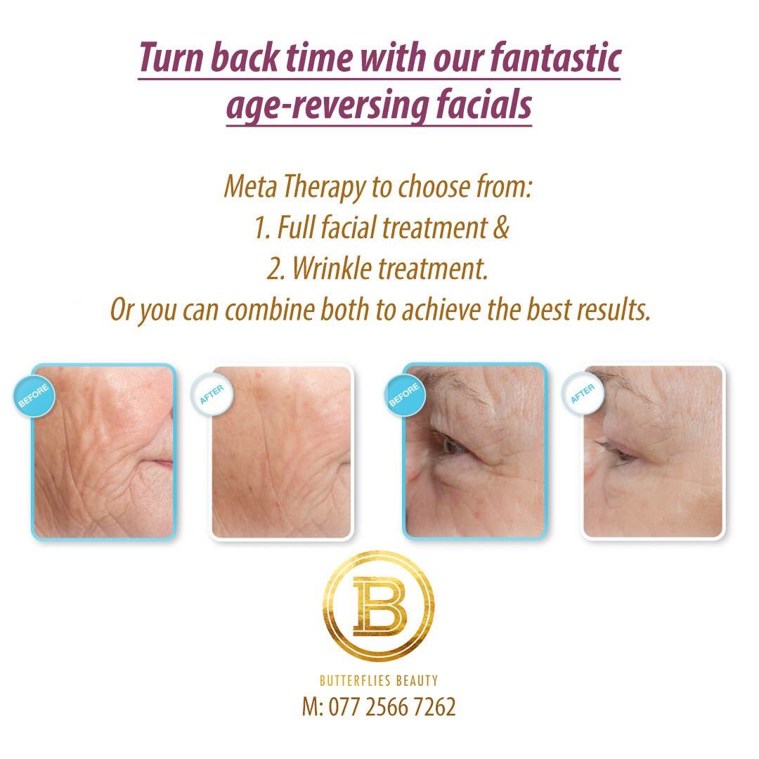 ButterfliesIPL's tweet photo. Turn back time with our #age-#reversing #facials. #Meta #Therapy to choose from: 1. #Full facial #treatment &amp; 2. #Wrinkle treatment. https://t.co/goHzuXO2pQ