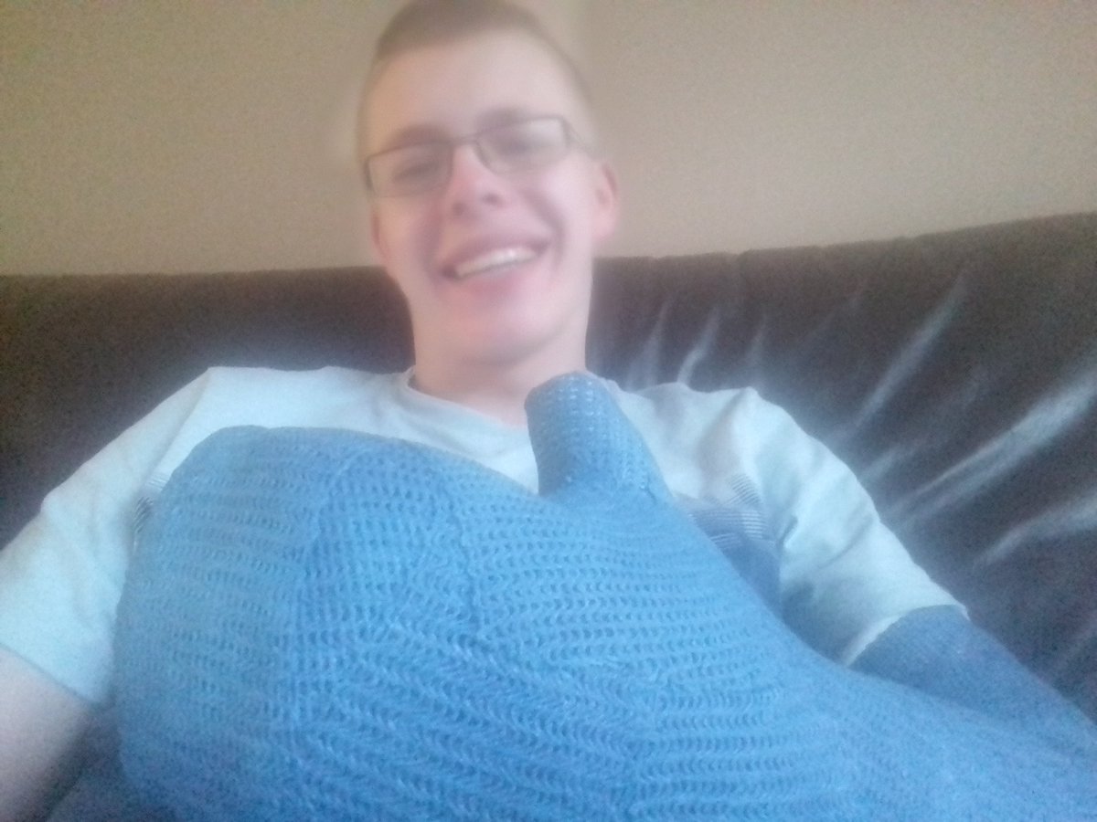 JoostGoes98's tweet image. Hey @evakoreman! Morgen mag eindelijk mijn gips eraf!!!! #ArmUpdate #Duimpie