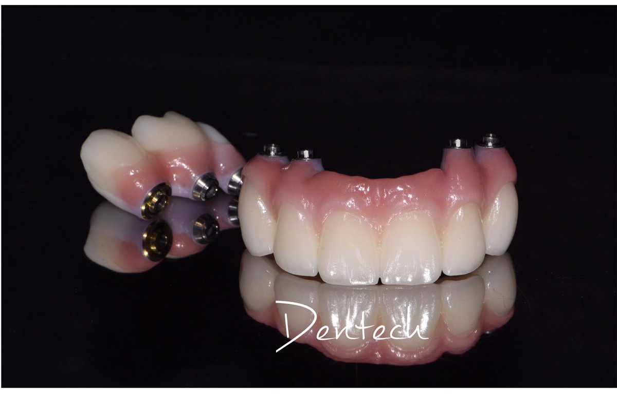 DenTechLab's tweet photo. ZEX Screw Retained Restoration #porcelain #Dental #prosthesis #Dentallab #esthetic #DenTech #pfz #zirconia #implantsupported https://t.co/b9rrPKyOzx