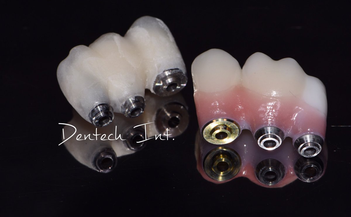DenTechLab's tweet photo. ZEX Screw Retained Restoration #porcelain #Dental #prosthesis #Dentallab #esthetic #DenTech #pfz #zirconia #implantsupported https://t.co/b9rrPKyOzx