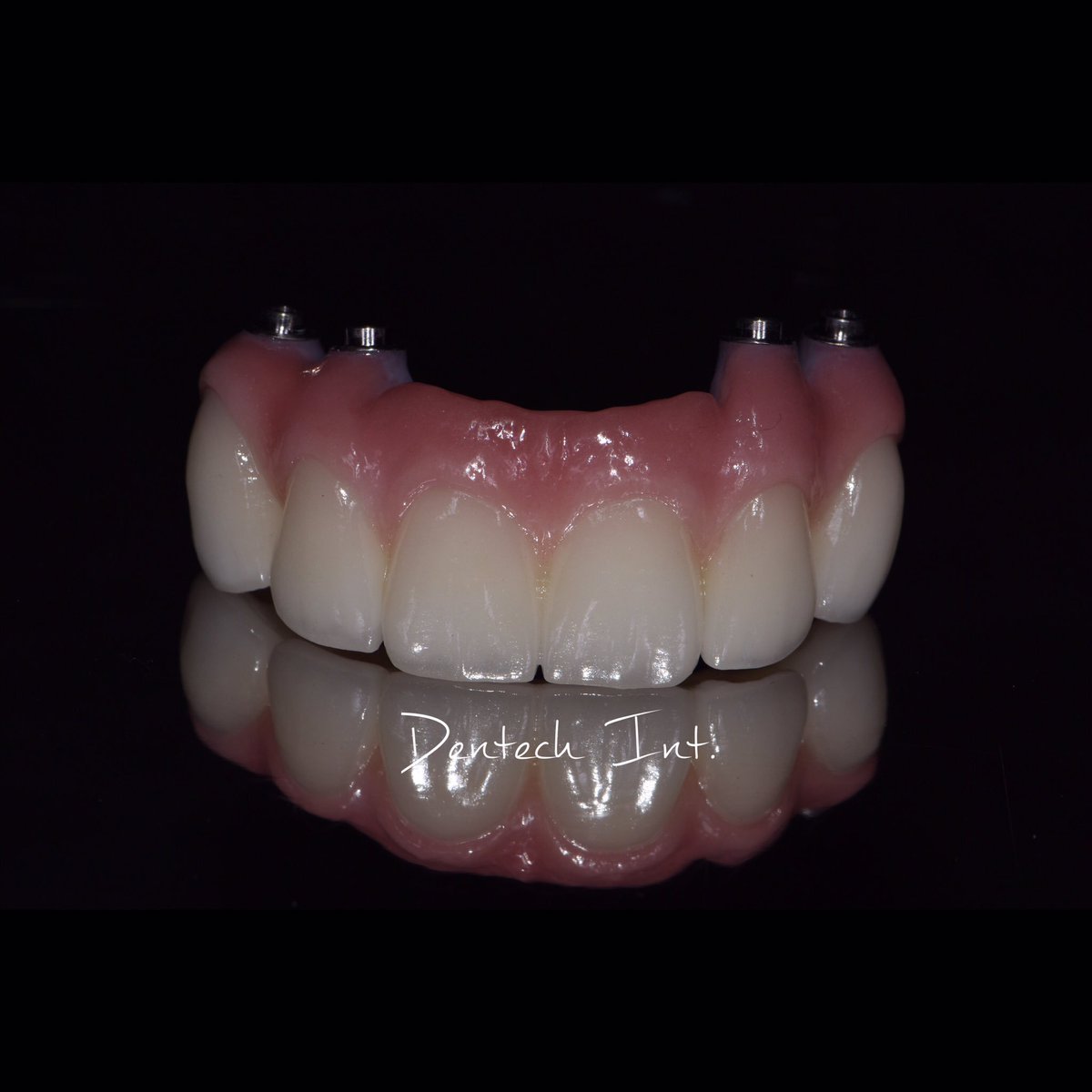 DenTechLab's tweet photo. ZEX Screw Retained Restoration #porcelain #Dental #prosthesis #Dentallab #esthetic #DenTech #pfz #zirconia #implantsupported https://t.co/b9rrPKyOzx