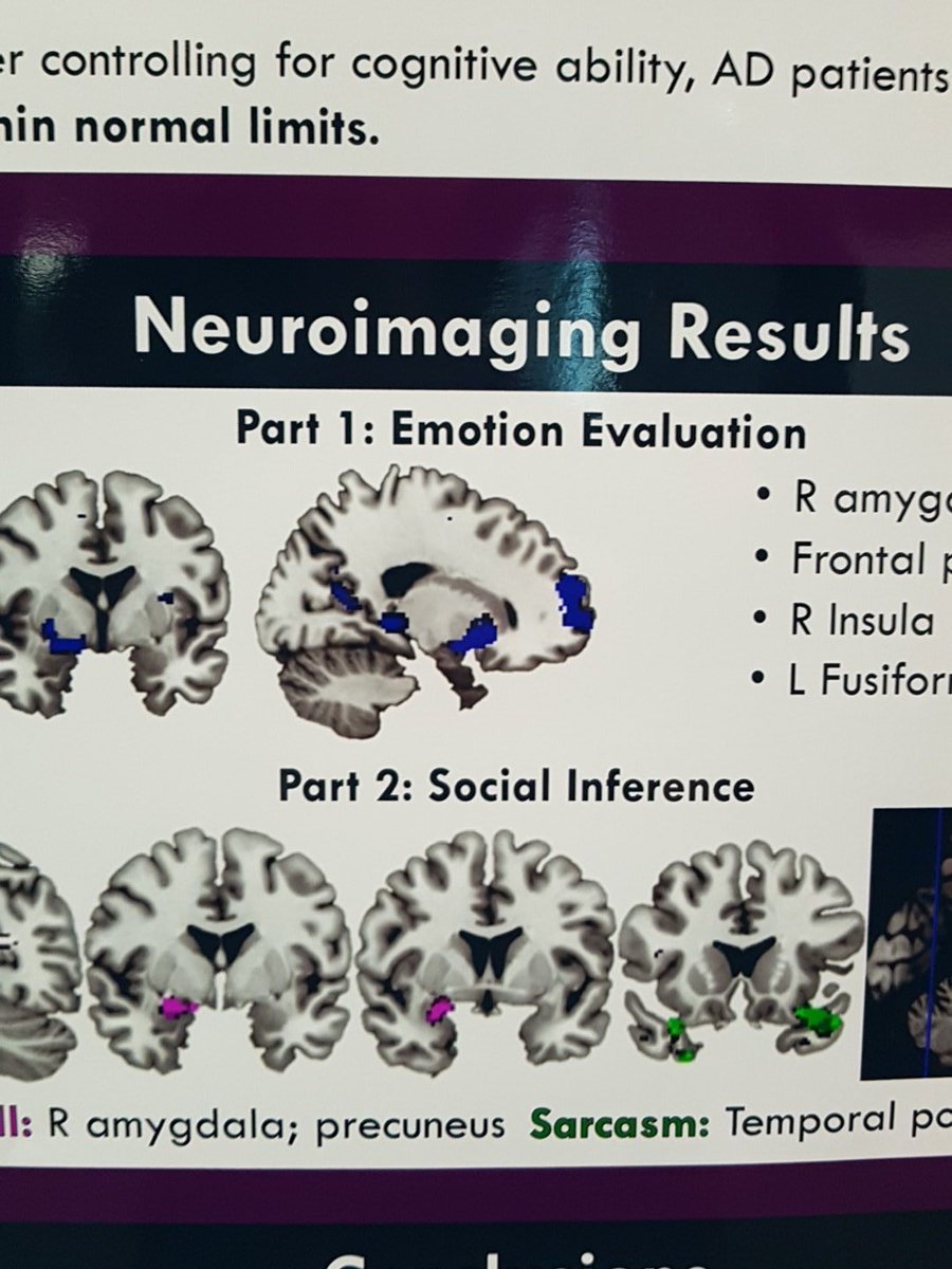 #movingahead_cre Understanding sarcasm requires the temporal pole and orbitofrontal cortex according to research by fiona kumfor