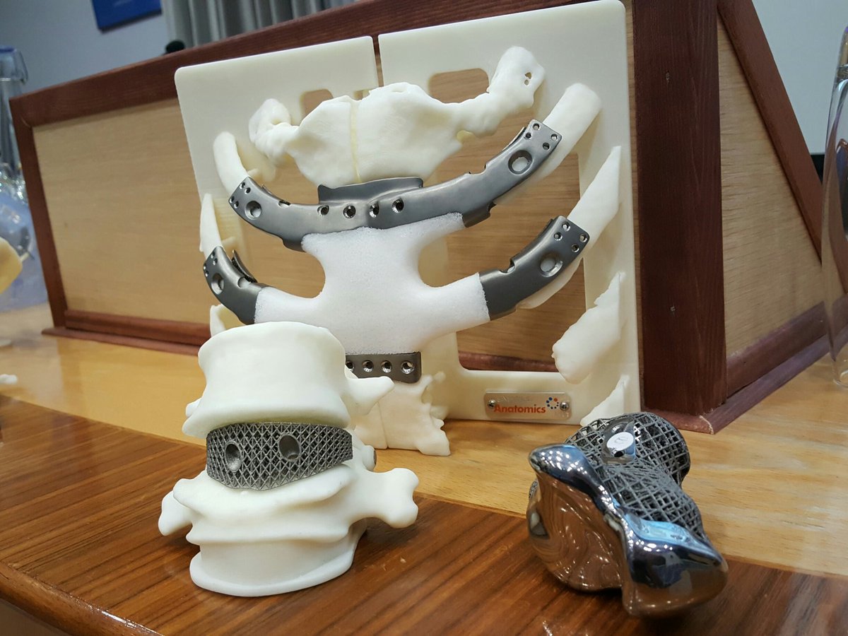 Great talk in LT2 coming up in 5min at LT2 #Nspine
#3D printed Titanium implants with <a href="/anatomics/">Anatomics</a>
