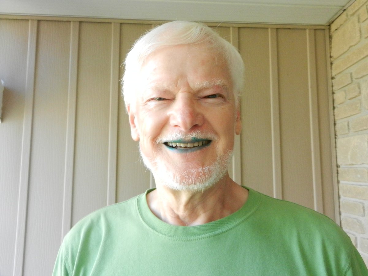Help me raise funds to find a cure. #greenlipschallenge #kidneycaner <a href="/KidneyCancer_Ca/">Kidney Cancer Canada</a> How am I doing @DebMaskensKCC  <a href="/StephenAndrew/">Andrew Stephen</a>
