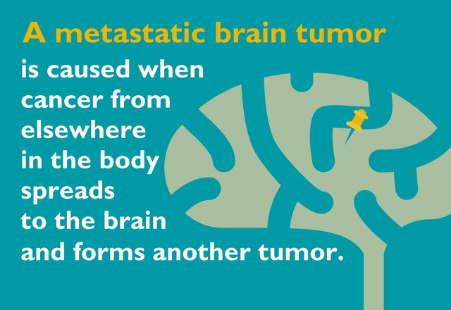 HopkinsMedicine's tweet photo. Have you or has someone you love recently been diagnosed with a metastatic brain tumor? https://t.co/V437zW91YS https://t.co/0DKqdoM9Ty