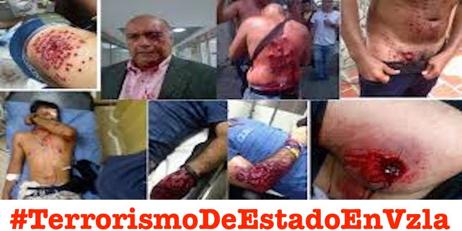 ladgerda's tweet image. Para los que siguen pensando en dialogo les muestro la atrocidades cometidas por la Dictadura venezolana
#TerrorismoDeEstadoEnVzla