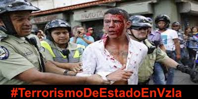 ladgerda's tweet image. Hoy mas que nunca necesitamos estar unidos, ya que es la única manera de acabar con esta Dictadura… @CNNVenezuela
#TerrorismoDeEstadoEnVzla