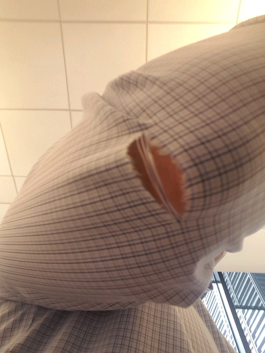 lorimorris's tweet photo. @BrooksBrothers - is this normal for a shirt that's 1yr old? Shouldnt it be better quality? Can you make this right for a longtime customer? https://t.co/Ub0Omdwyjl