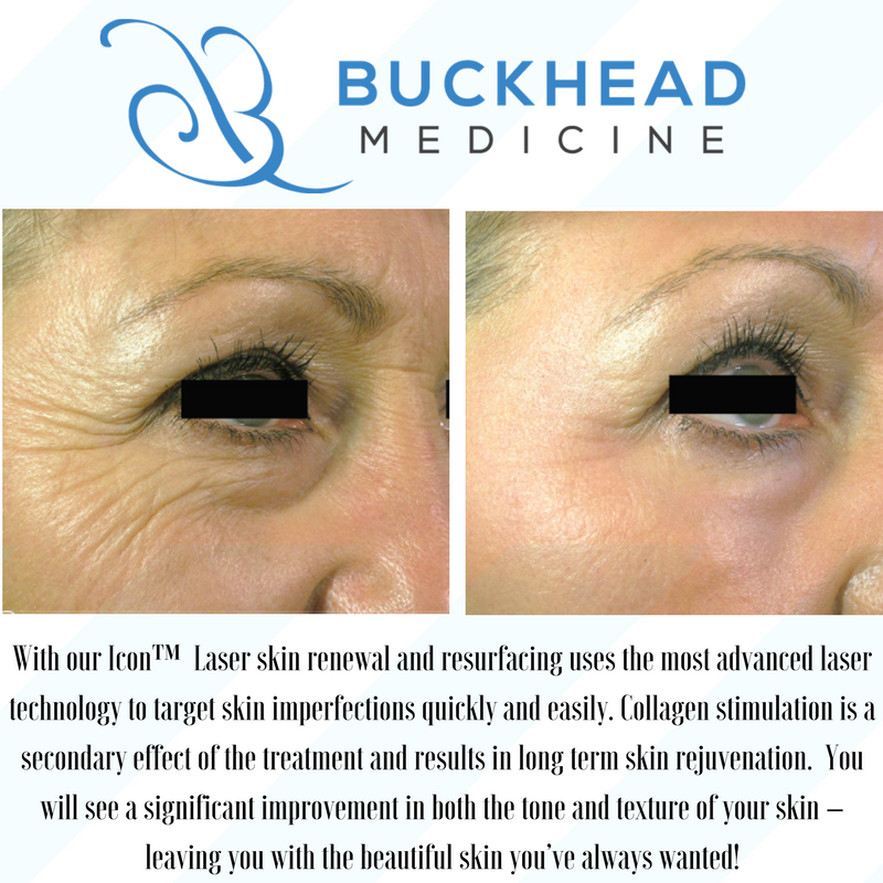BuckheadMed's tweet photo. Laser skin resurfacing here at #Buckhead Medicine https://t.co/gFj42MmPNU #BuckheadDoctor #skincare #LaserSkinResurfacing Cynosure Lasers https://t.co/xdwtnyL6hl