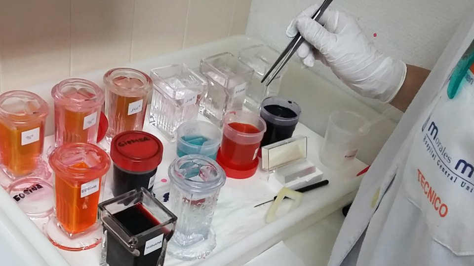 edusqo's tweet photo. Preliminary results w #cytotechs in Rapid On-Site Evaluation 🔬 #FNA #Cytology #Simulation... just 4 the #PatientSafety. Today at #SESAM2017 https://t.co/2Mj943gjzv