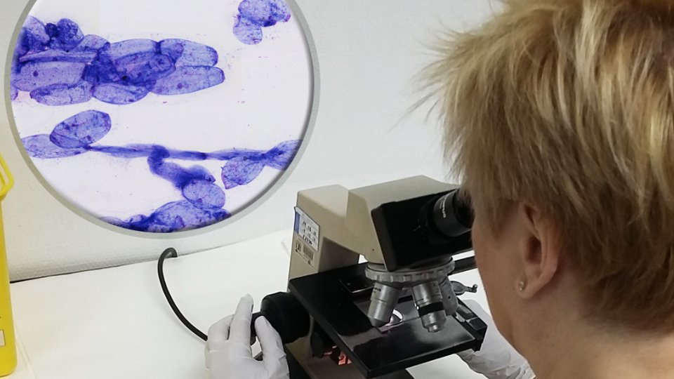 edusqo's tweet photo. Preliminary results w #cytotechs in Rapid On-Site Evaluation 🔬 #FNA #Cytology #Simulation... just 4 the #PatientSafety. Today at #SESAM2017 https://t.co/2Mj943gjzv