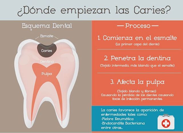 ClinicCenterBCN's tweet photo. ¿Qué le hacen las caries a nuestros dientes?¿Cómo arranca ese proceso?¿Y qué otras consecuencias pueden llevar aparejadas? 

#ClinicCenter https://t.co/sMYjc2Zc70