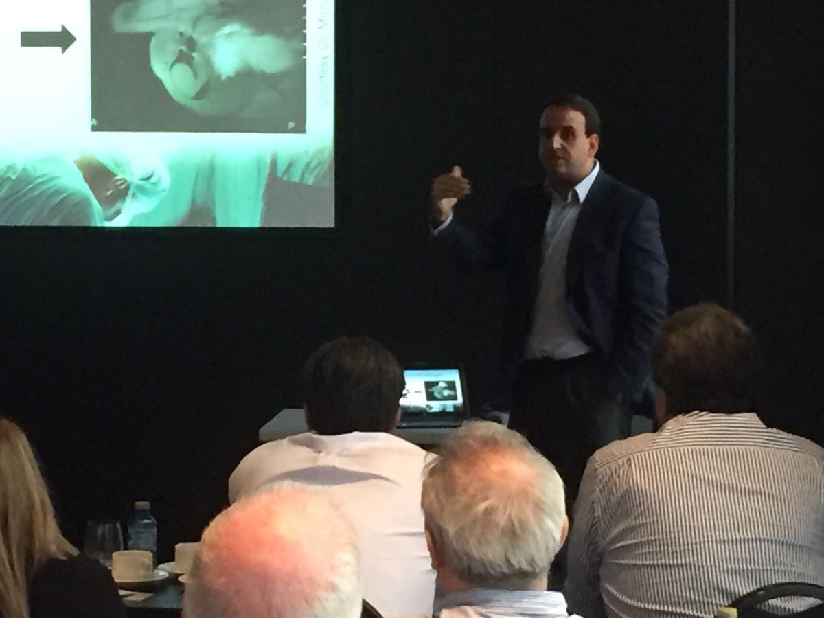 Dr Mtez-Salamanca (@mtezsalamanca) on Twitter photo European Masterclass of Erectile Restoration, just opening!! Hope we enjoyed a great surgical day!!
@lyxurologia <a href="/essm_tweets/">European Society for Sexual Medicine (ESSM)</a> <a href="/IDIPHIM/">Inv Puerta de Hierro</a> European Masterclass of Erectile Restoration, just opening!! Hope we enjoyed a great surgical day!!
@lyxurologia <a href="/essm_tweets/">European Society for Sexual Medicine (ESSM)</a> <a href="/IDIPHIM/">Inv Puerta de Hierro</a>