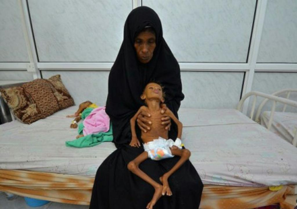 JordanRodB's tweet photo. 1.Me hablan de crisis humanitaria... Crisis la de los niños en Yemen que si se salvan de las bombas saudies mueren cada 10 minutos de hambre https://t.co/sfltkPvORG