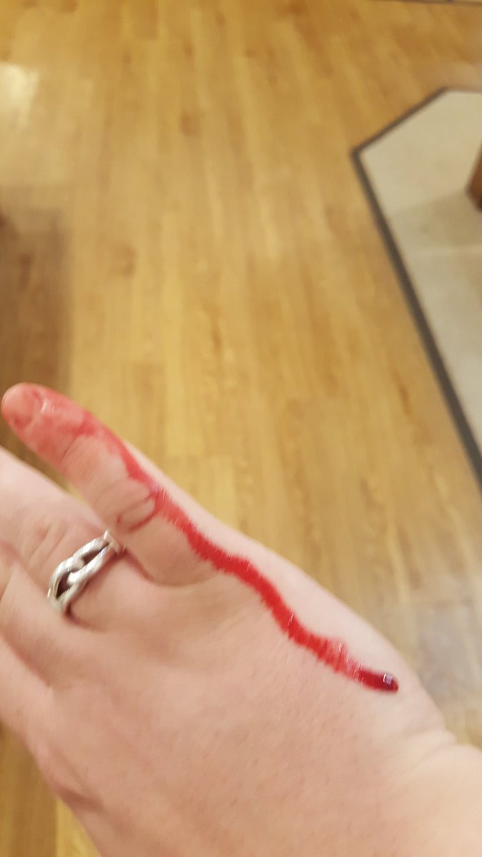 Jimmy_Heard's tweet photo. @LeeLonglands First Aid shambles in Bham store. Staff first response was "no wipes/plasters, you'll just have to run under a tap" Appalling https://t.co/fVtmT7GQQG