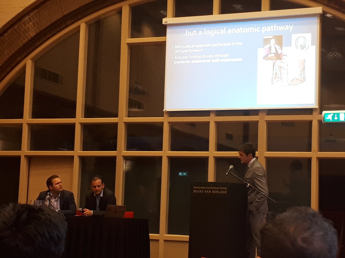 Vosdanielle's tweet photo. Rare case of a lumbar abscess caused by appendicular #perforation, discussed here at #ESSR2017 by Dr. Douissard https://t.co/4gw1Ia1jcr