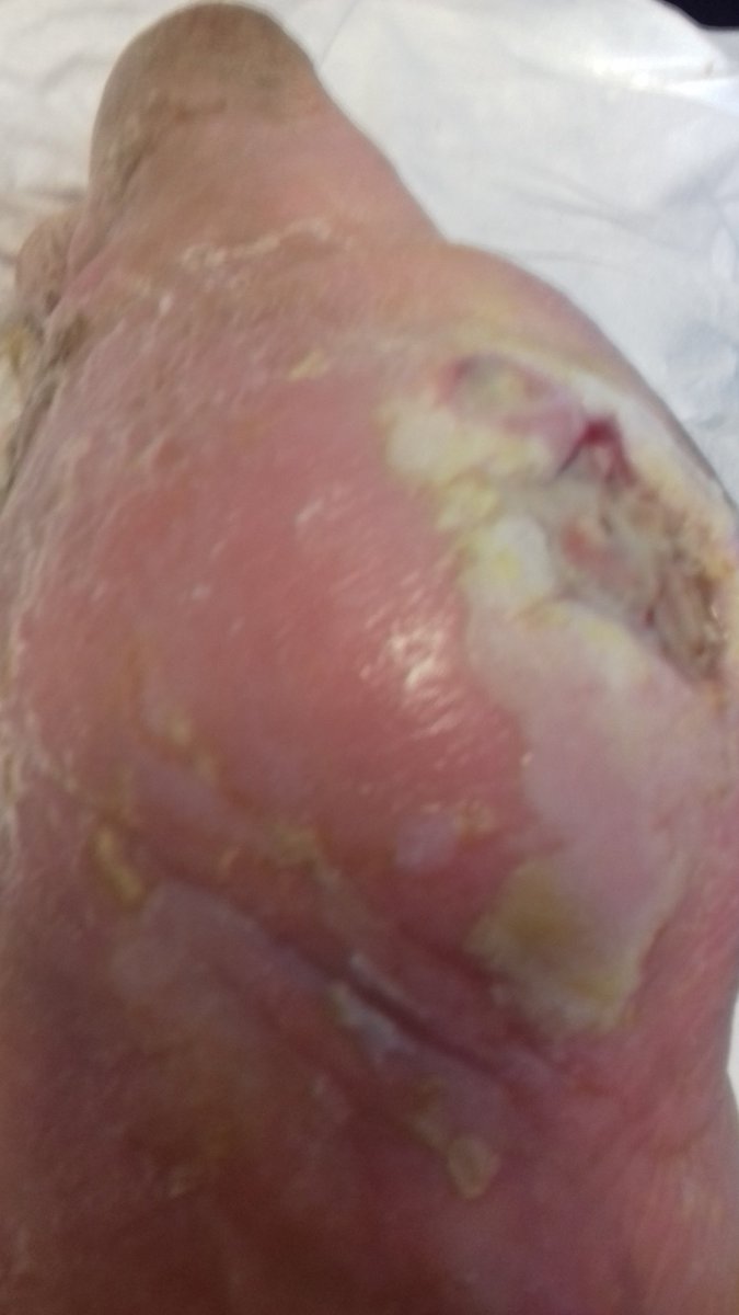 Colin Watson tweet media