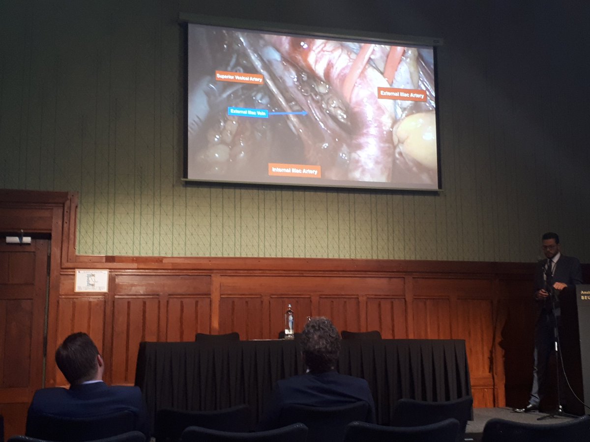 Vosdanielle's tweet photo. Really nice and clear presentation by @A_navsan about lateral pelvic lymph node dissection in #rectalcancer. #ESSR2017 #colorectalsurgery https://t.co/ZlNjUNSQW8