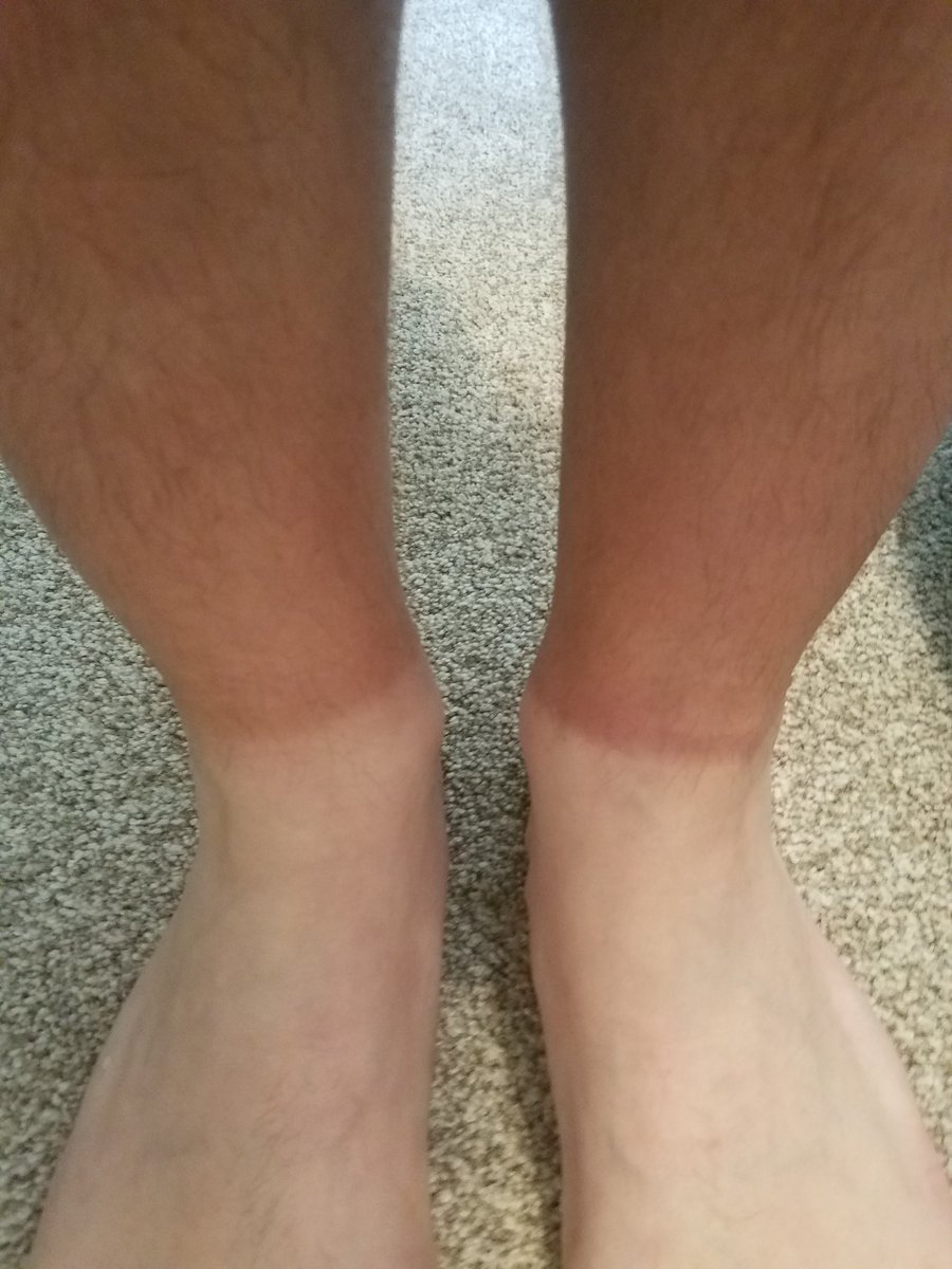 Cowbell_Nation's tweet image. #SoftballDadProblems