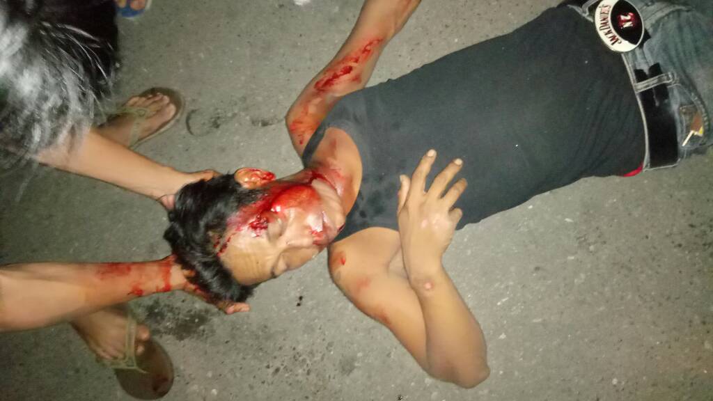 Lakalantas tunggal di jl.Vetran depan Masjid Al Ikhwan Bjm unt korban d evakuasi k IGD Rs Ulin . info 33MNFR via Freq.RPU MNFR 159.090 Mhz