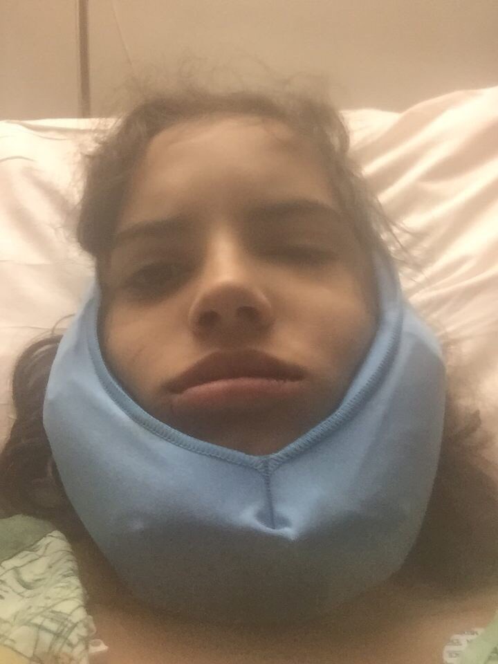 laramsalgado3's tweet photo. 1 yr. ago (yesterday) my jaw was broken &amp; face changed completely. i've never been more confident after it happened... #ripunderbite :)) https://t.co/0rWEw2ZwSC