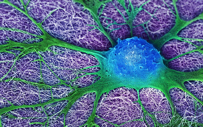 SiSNorthwestern's tweet photo. "Neural Cell Looking For Friends" by Mark McClendon of @NorthwesternEng. Submit YOUR #scientificimage: https://t.co/6Cq4IWgVL1 https://t.co/cj29xlPfyk