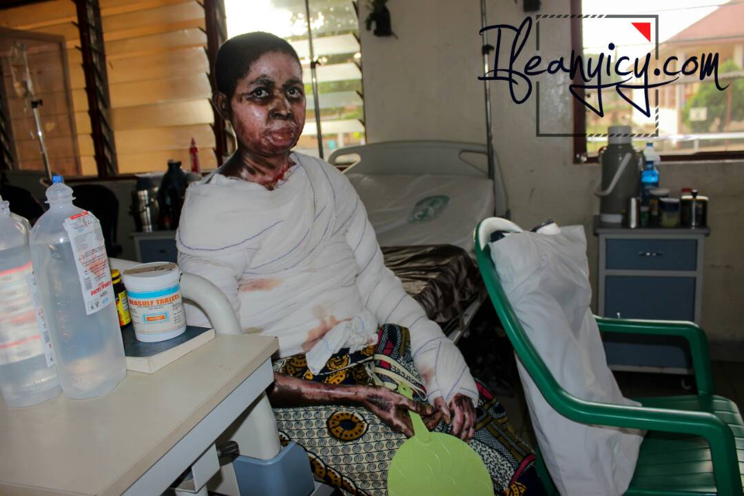 ifeanyicy's tweet photo. Let's contribute &amp; save Poor Women #FireBurnt  #Ward7 FMC https://t.co/zpr4vs4JUl bill:N418,https://t.co/N5IogUwc0r 08177868332 @ogundamisi https://t.co/2sn4d21B4O