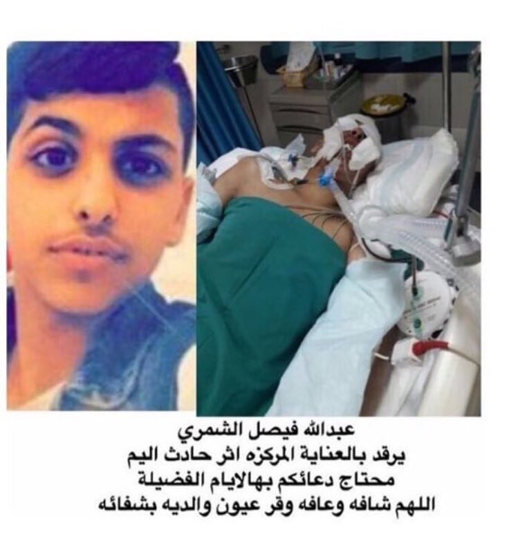 alsaeed70's tweet photo. ولد عمره ١٦ يرقد بالعناية اثر حادث 
ما ياخذ من وقتك شي لو سويت #رتويت 
ودعيت له وخليت غيرك يدعي له 
الله يشافيه يارب 

 #اوامر_ملكيه https://t.co/uLCKGctzL7