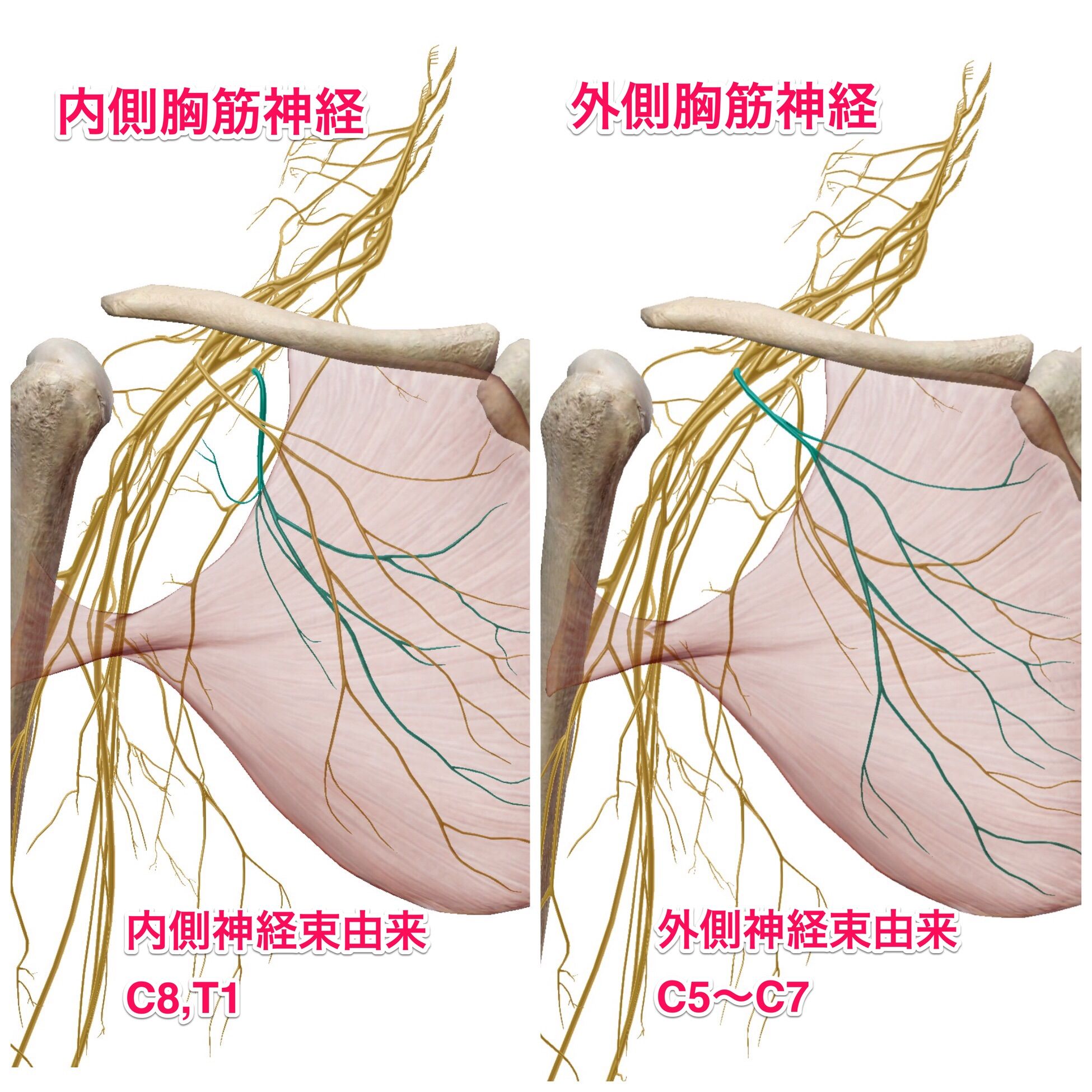 かずひろ先生 なるほど解剖学 on Twitter: "『内側胸筋神経と外側胸筋神経』 内側胸筋神経はC8, T1 からの 下神経根からの ( 束) に由来する 外側胸筋神経はC5〜C7の上・中神経根からの ( 束) に由来する 両神経は大胸筋と小胸筋を支配する。 画像出典元 https://t.co ...
