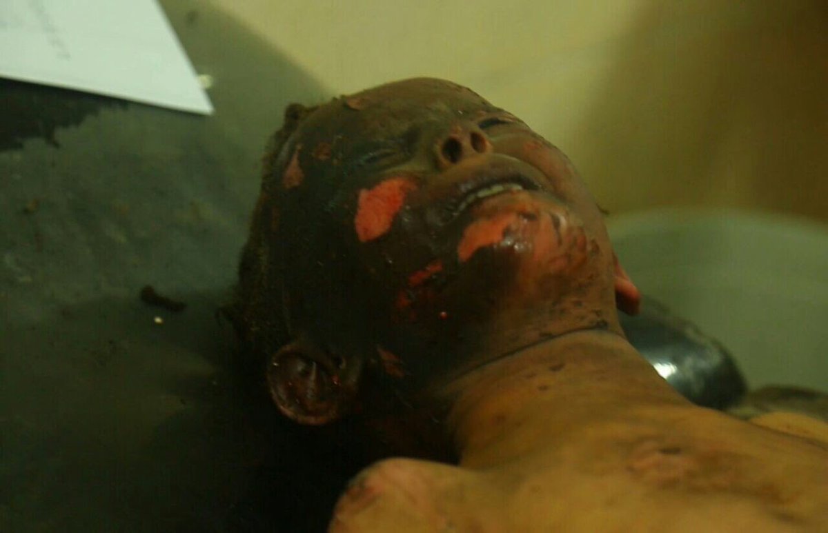 أطفال الرقة الشهداء بالقصف الأمريكي الجوي ، والمدفعي لعملائهم الأكراد
" لا بواكي لهم " لأن إرهابهم حلال!!