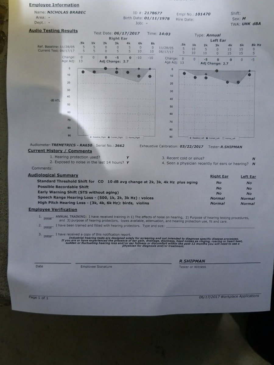 NLB1Dukesta's tweet image. Annual hearing test completed! Hearing &quot;great! #bionicears