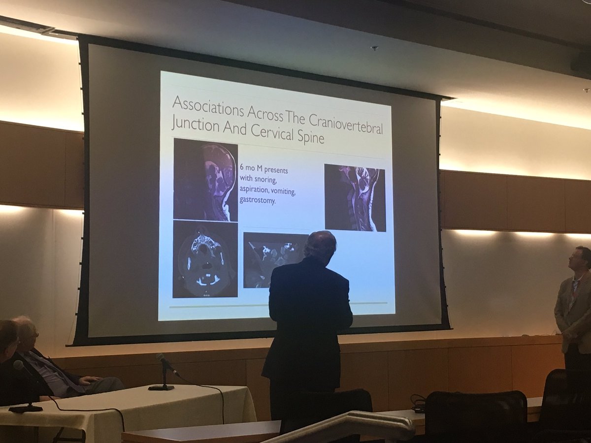 bobbyjonescsf's tweet photo. Dr. Rekate and Dr. Henderson explain the measurements of craniovertebral #instability, included in the CSF developed #Chiari CDEs. #BrownCSF https://t.co/h2qbDdV175