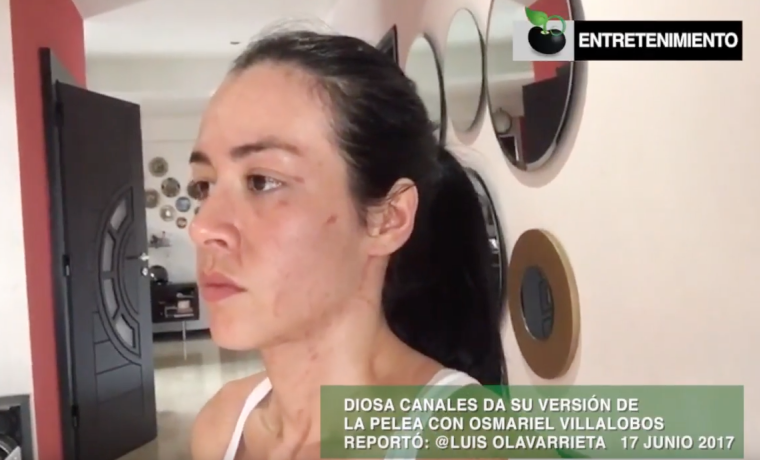 Josjua's tweet photo. En exclusiva Diosa Canales ofreció su versión tras pelea con Osmariel Villalobos (+Video) https://t.co/837n3cHcMs https://t.co/sajvxj806x