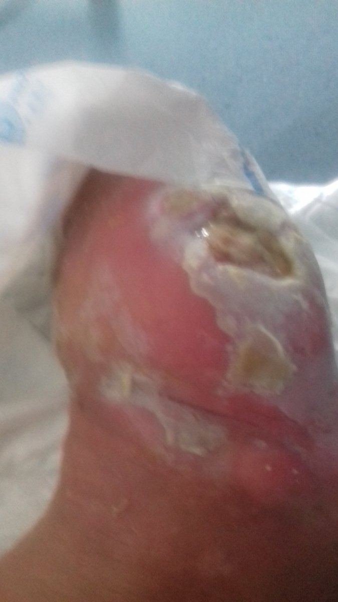 Colin Watson tweet media