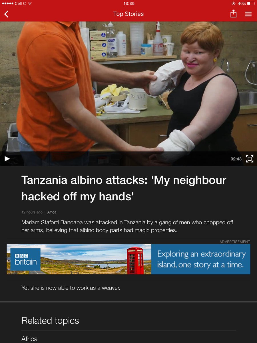 Tanzania WTF??? #albino THIS HAS TO STOP. NO!!!