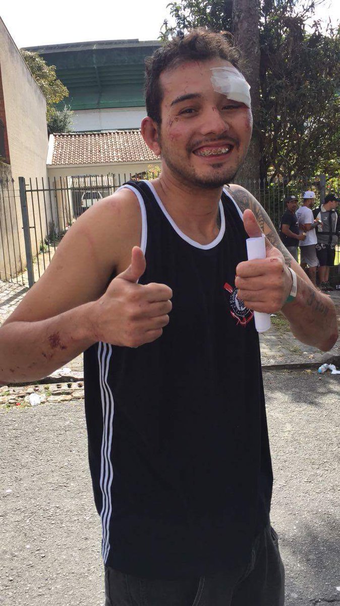 DoentesPFutebol's tweet photo. Foi espancado 
Morreu
Noticiaram para o Brasil sua morte 
Viveu
Ficou em estado grave
Recebeu alta
Tirou foto fazendo joia
Voltou pra SP https://t.co/BeF7t7WjaJ